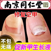 Tongrentang hot sale. One drop of it the effect is so good. Bad nails can be turned into good nails. Finger and toes can be repaired and become good. Potassium