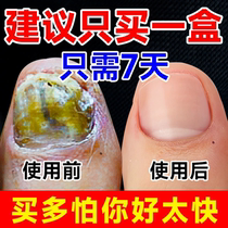 (Tongrentang hot sale) One drop of it inhibits bacteria without removing nails and removes 99% of gray potash fungi. Return guarantee if invalid.