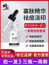 (Amending Oligopeptides Fine China Liquid) Acne Anti-Acne Net Pimple Shine with bright complexion pimple-pimple recommendation