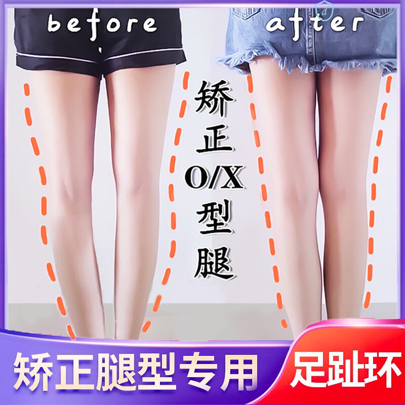 Inner Eight Words Foot Straightener Leg Type Straightener Straight Leg Xo Type Leg Foot Foot Valgus Toe Ring Calf Valgus Insole
