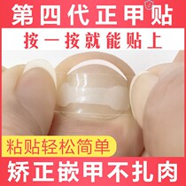 Foot-toenails long-to-meatosis orthodontic orthodontic orthodontic ligritosis Correction of foot nail devinator Inlaid Patch