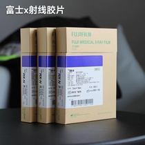 Fuji x-ray film WB exposure immunoblotting ECL chemiluminescence autoradiography biological laboratory