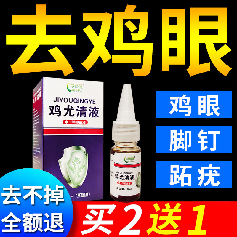 Corn cream foot nails to remove corns on the soles of the feet paste foot plantar warts ointment warts meat thorns calluses chicken Youqing antibacterial liquid