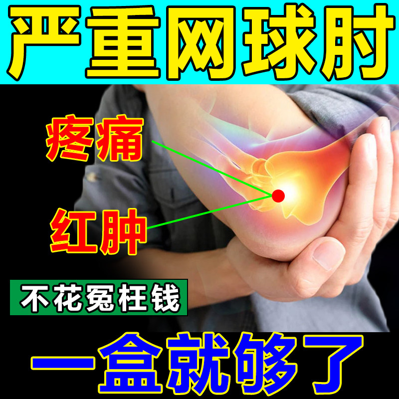 Tennis elbow special plaster paste elbow joint elbow pain paste tendon sheath transdermal moxibustion elbow nemesis artifact