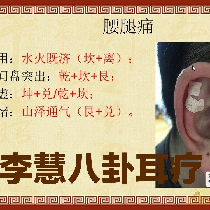 Li Hui's gossip ear therapy 53 sessions of high-definition video tutorials for waist and leg pain, insomnia, zero-based water and fire combination tutorial