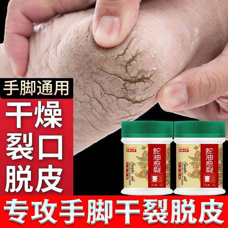 Anti-cracking cream hand, foot and foot cracking cream cures dry and cracked heels, anti-freeze cracking moisturizing cream, cracking snake oil hand cream S