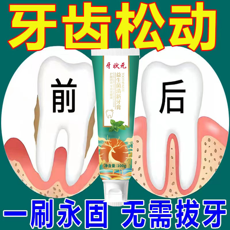 (One brush to fix teeth) loose teeth repair fixed teeth swollen and painful gums shrunken dental plaque care tooth champion toothpaste