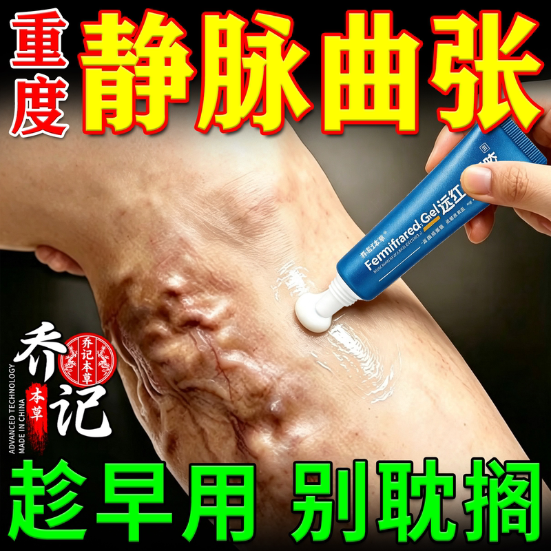 Specialized Effective Ointment Patch for Varicose Veins, Used to Assist in the Treatment of Bulging Veins and Red Blood Streaks in the Lower Limbs and Legs