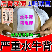 Trapezius muscle elimination artifact improves rounded shoulders hunchback thick shoulders special goddess thin shoulders and thin back dredging artifact patch