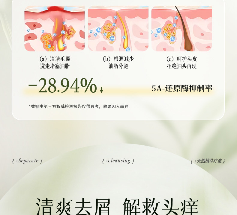 【中国直邮】 VHE 去屑洗发水 控油蓬松柔顺长时去油庠男女洗发露 400g/瓶