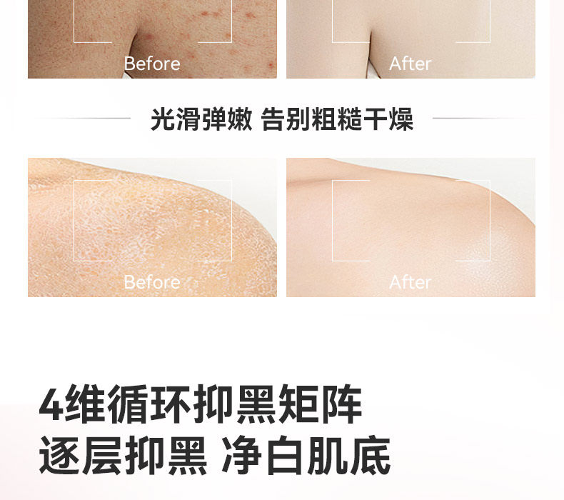 【中国直邮】 VHE 祛痘美白沐浴露 全身焕亮保湿水润持久留香乳液洗护男女 400g