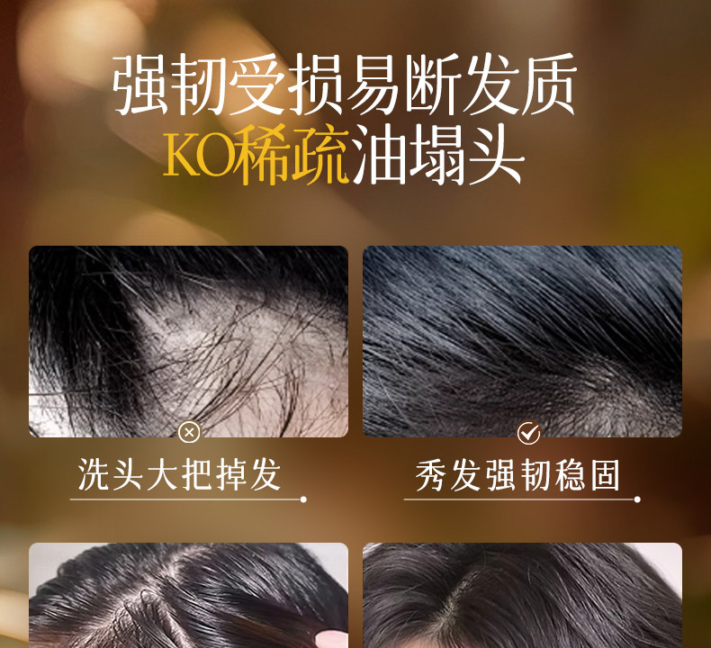 【中国直邮】 VHE 防脱洗发水 强韧健发洗发露控油蓬松男女防掉发洗头膏 400g