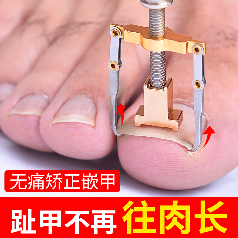 Special Tool for Correcting Ingrown Toenails, Nail Clippers, Toenail Correction Tool, Pedicure Tool, Eagle-Beak Pliers for Inflammation Special Tool for Correcting Ingrown Toenails, Nail Clippers, Toenail Correction Tool, Pedicure Tool, Eagle-Beak Pliers for Inflammation