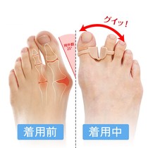 Toe aligner toe-in-toe female foot finger type large footed bone child thumb valgus straightener wearing shoes