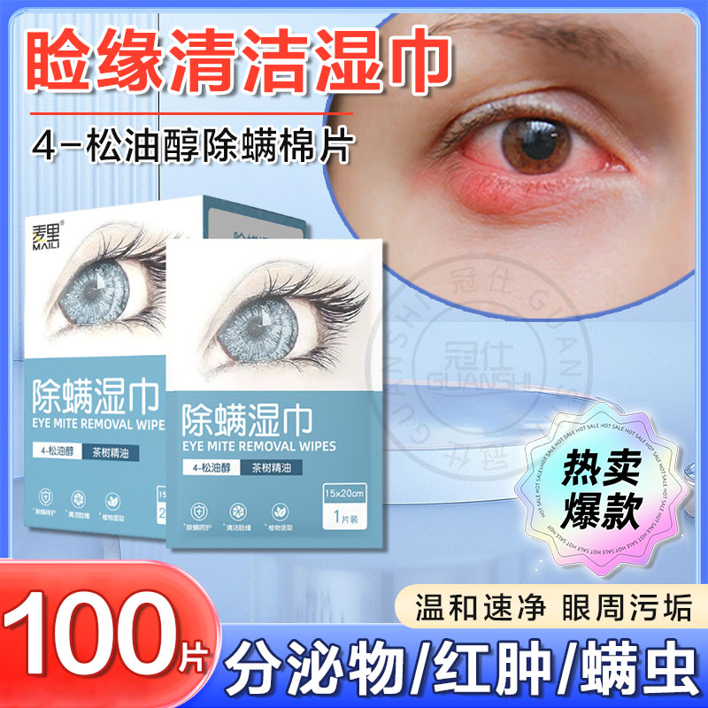 睑缘清洁湿巾4松油醇眼部专用清洁干痒贴分泌物眼除螨棉片眼痒tl