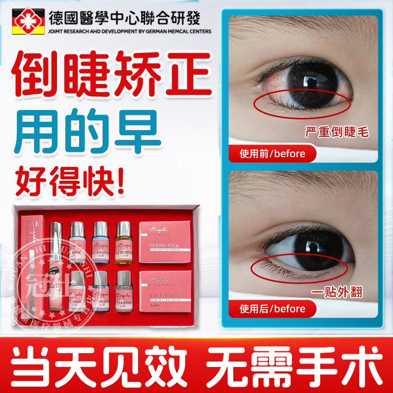 倒睫毛矫正贴儿童矫正器治倒睫成人疗下眼睑下睫毛定型专用神器sy