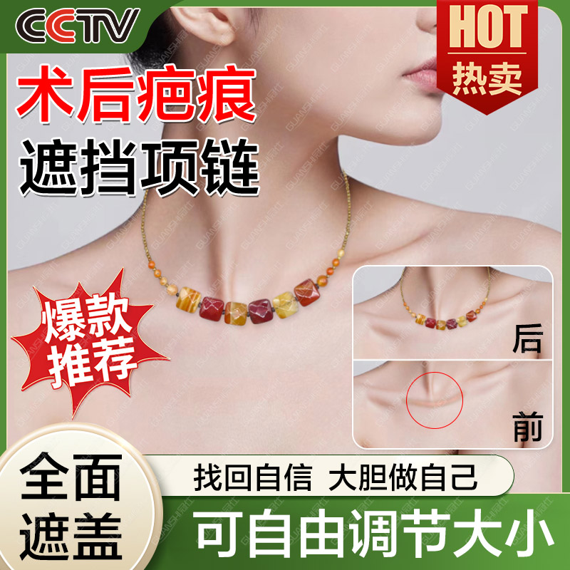 玛瑙项链甲状腺术后遮挡神器百搭锁骨链脖子遮疤女款夏天锁骨链dx