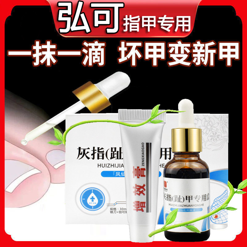 Hongke nail special box gray nail liquid synergistic cream toenail thickening and blackening gray impatiens treatment medicine