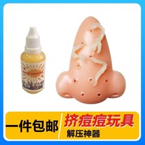 Pimple squeezing and decompression artifact pimple squeezing toy blackhead squeezing toy girls’ decompression toy pimple squeezing to relieve gas