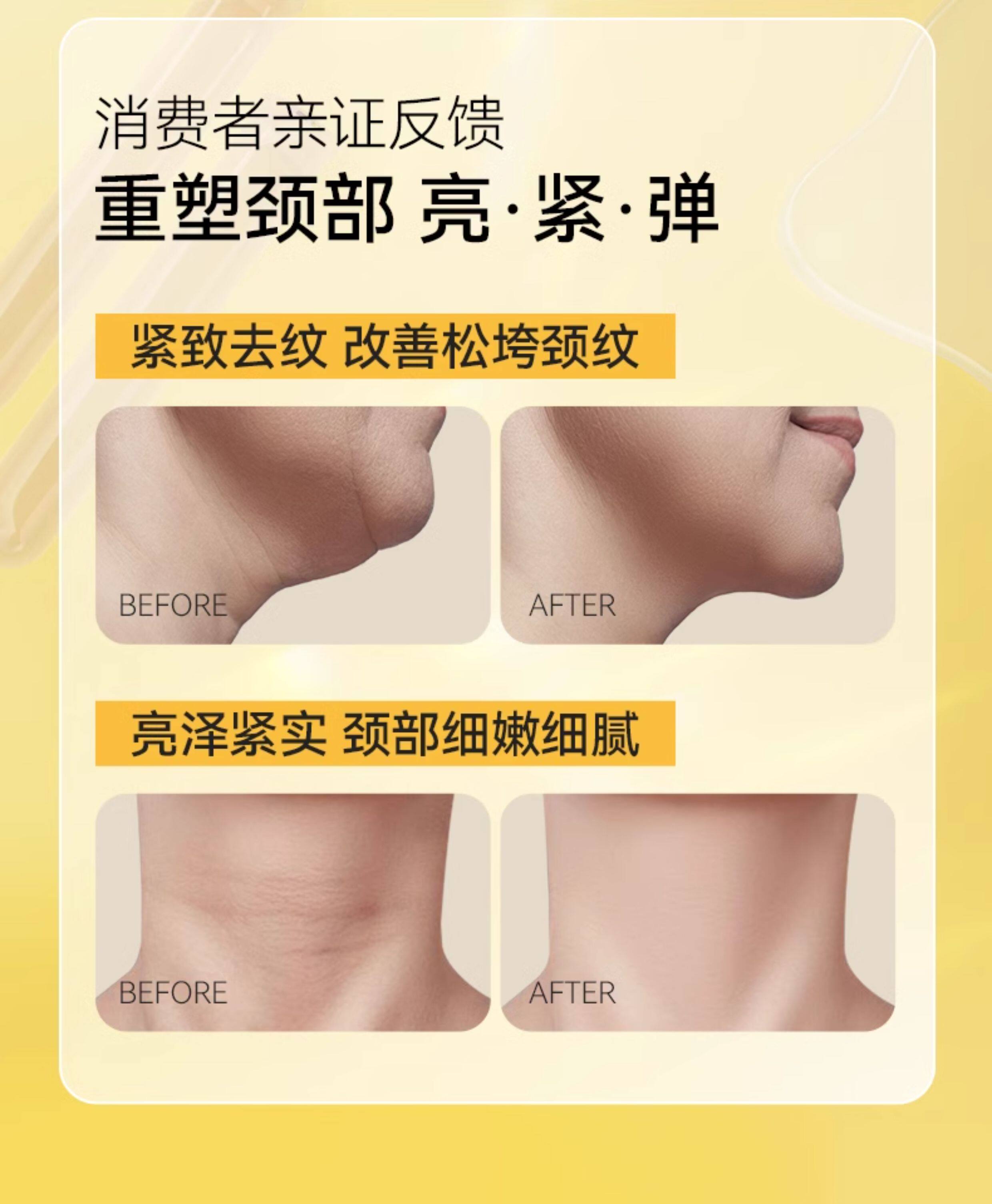 【中国直邮】  奢笛熊 颈胸手足保养 颈膜 多肽紧致抗皱去颈纹贴 保湿补水焕亮脖子护理颈霜面膜 7片/盒