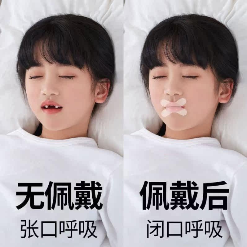 Stick lips artifact closed children's sticky mouth stickers anti-open mouth children's closed mouth stickers adult anti-mouth convex suction stickers to stop snoring