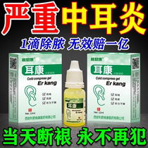 Otitis media ear drops for people with otitis media ear itching itching antibacterial ear discharge pus and water inflammation special ointment