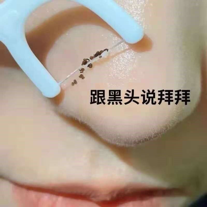 (Weiya recommends buying 2 to send 1) The black head is gone to clean the black and white head deviner ~ tear out the dirty stuff