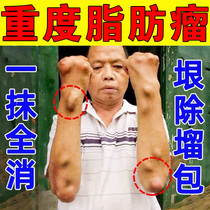 Lipoma removal artifact antitumor paste paste Baikangtang Chinese herbal medicine special to eliminate subcutaneous lumps multiple nemesis