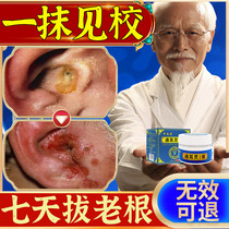 Middle ear canal washing inflammation pain special ointment boric acid borneol ear drops human ear itching medicine ear pus cleaning artifact