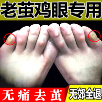 Go to the toes calluses and foot cocoon artifact to remove the soles of the feet calluses dead skin softener thick crusty soles foot pads