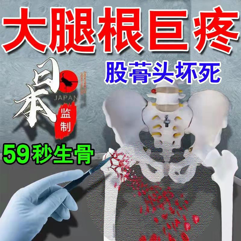 Hip pain paste hip coccyx femoral head hip pain synovial effusion treatment necrosis paste sacroiliac joint paste