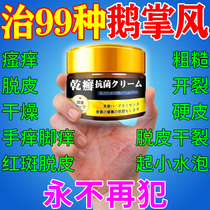 Japanese goose palm wind hand ringworm ointment (packet smelting) palm dry cracked peeling blister fungal infection sterilization special ointment