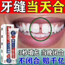 Tooth gap wide repair artifact front tooth gap big plugged tooth gap special filler regenerative silicon cleaning toothpaste
