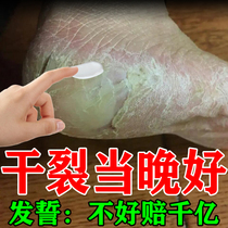 Cracked heel repair cream foot cracking sole foot cracking treatment cream hand and foot peeling cracking Vaseline hand cream