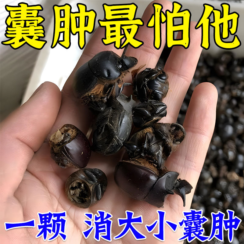Sebaceous gland cysts special vestibular large glands glands Acne Pimple Pimple Pimple with toxic paste Pussy Removal-Taobao