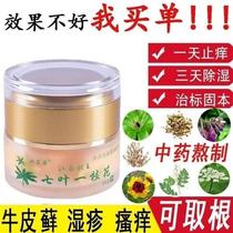 Aesculus aesculus ointment herbal cream antibacterial and anti-itch skin topical cream Aesculus aesculus