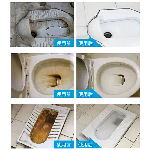 Туалет, мусс, дезодорант, гигиеническое чистящее средство, гигиенический спрей, удаление пятен