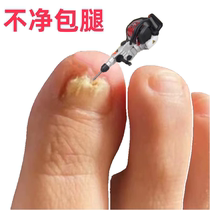 (Tongrentang hot sale) Painless replacement of potassium enjoy a good nail life turn bad nails into good ones drop by drop