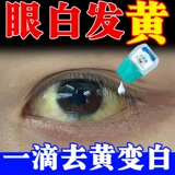 Глаза белые и ясные желтые, жидкие, жидкие, макулярные поражения.