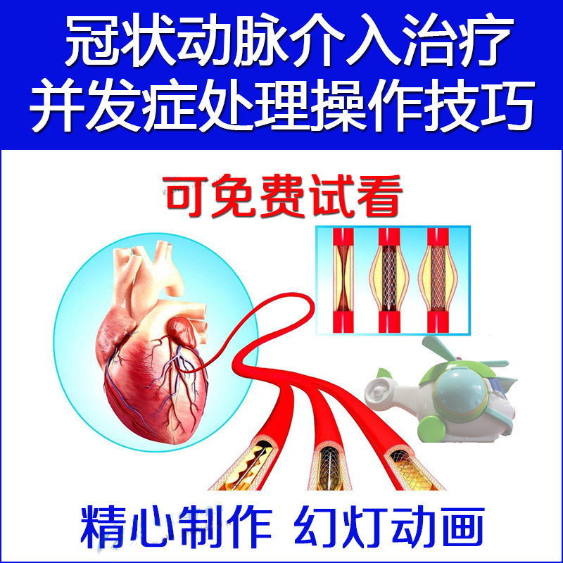 Coronary Artery Coronary Intervention Complications Treatment Operation Skills Cardiovascular Guidewire Interventional Angiography Tutorial