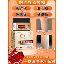 Obesity mark repair cream removes growth marks on thighs student butt fades stretch marks removes obesity marks for men