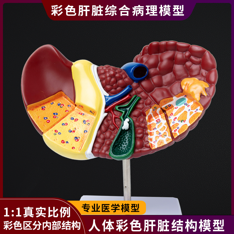 医学仿真人体肝脏解剖模型肝门胆囊胆管结构消化系统器官演示教具