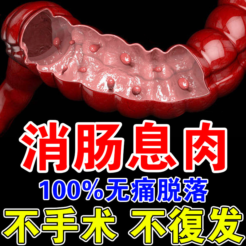 100% Intestinal Polyps Patch for Colitis, Gastritis, Abdominal Pain and Diarrhea