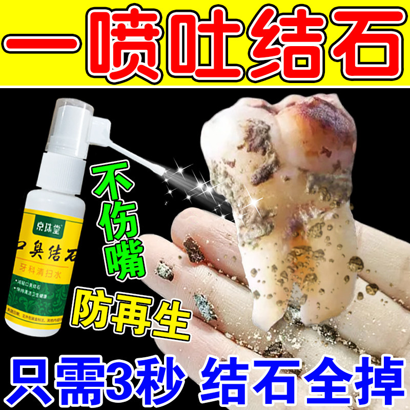 Special spray for removing dental calculus quick-acting dissolving dental calculus sterilization in addition to bad breath and tartar stains artifact non-toothpaste
