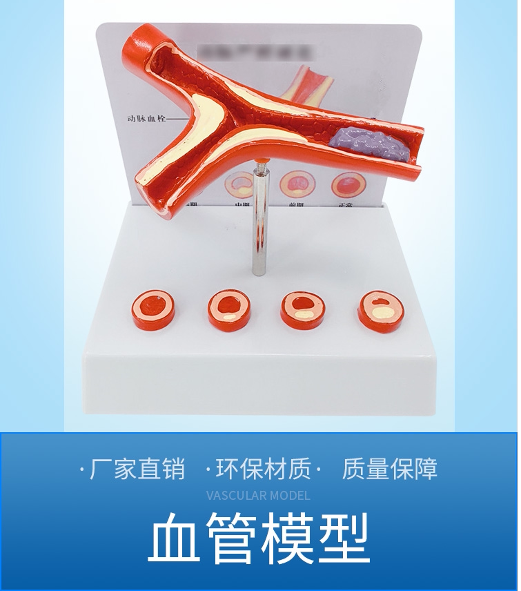 人体血管病理解剖模型堵塞血管 血液浓度脂肪 病理血液 血管粥样