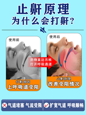 Анти-храп продукты 打呼噜治根的专用药鼾立停止鼾神器成人男女重度打鼾睡觉防呼噜贴