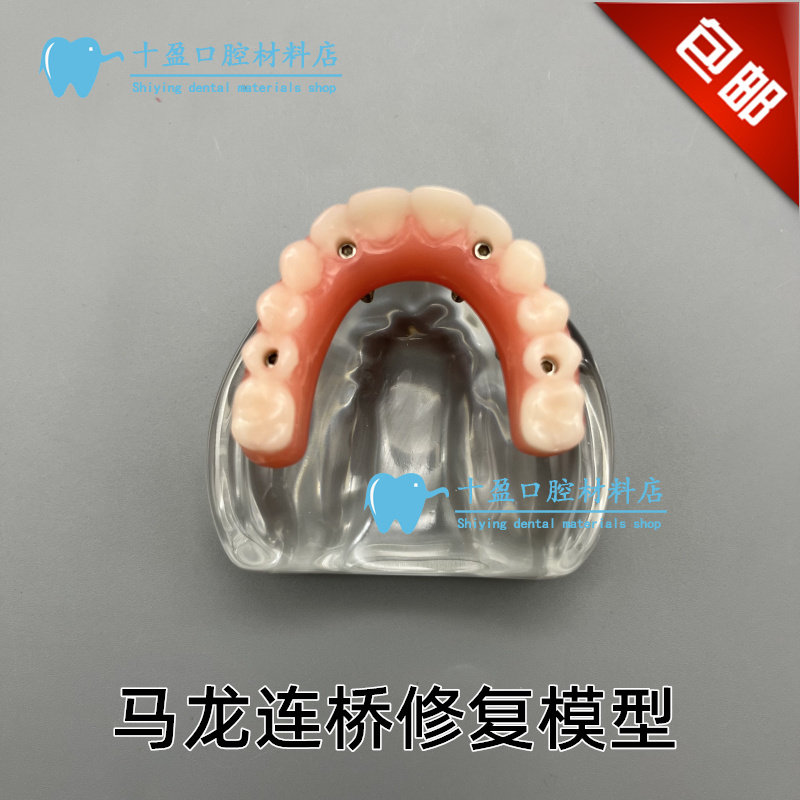 牙科口腔模型马龙连桥义齿修复种植牙齿仿真演示模拟教学医患交流