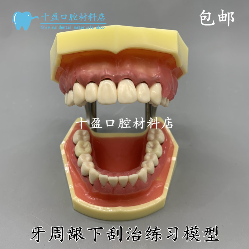 牙科口腔模型练习牙结石龈上龈下刮治模型牙结石牙周病理牙齿模型