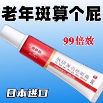 Spot removal cream specializes in removing age spots special face removal ointment for hands and back of hands powerful removal