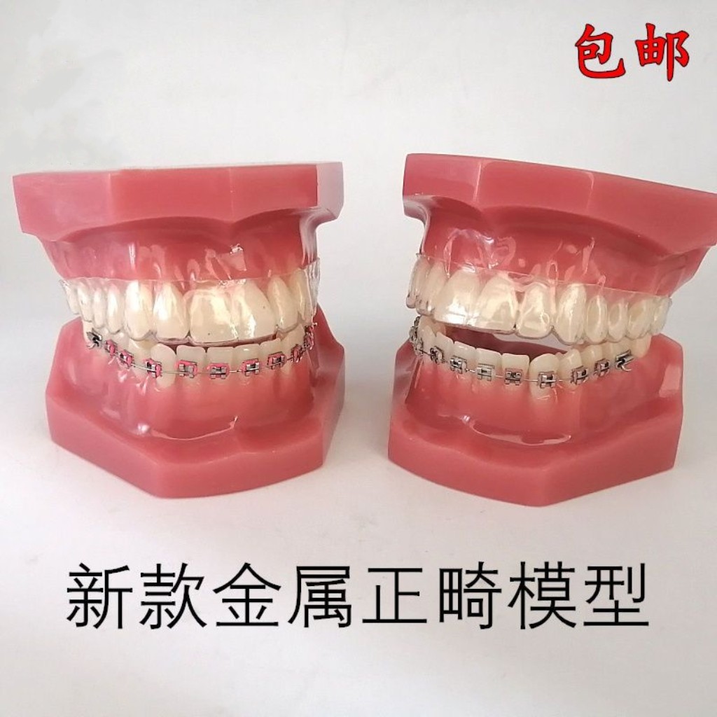 牙科口腔教学模型 隐形正畸矫正模型 金属正畸模型 口腔展示模型